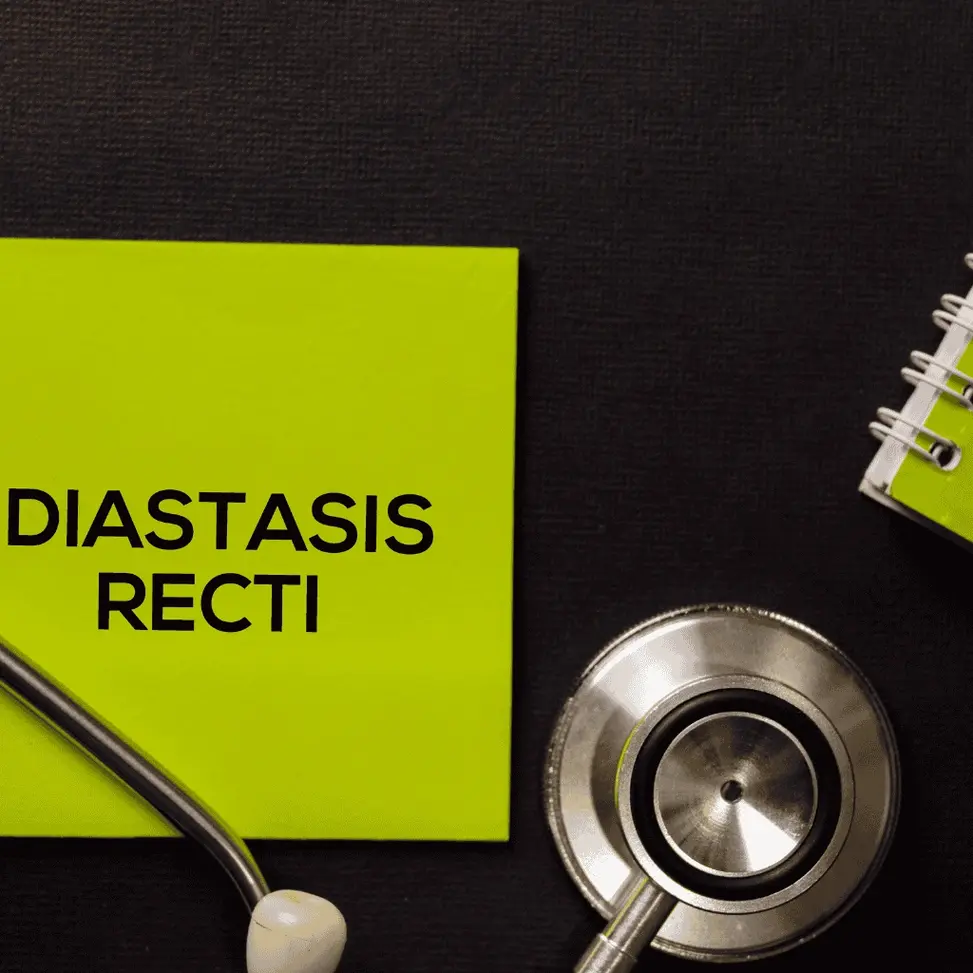 diastasis-des-grands-droits